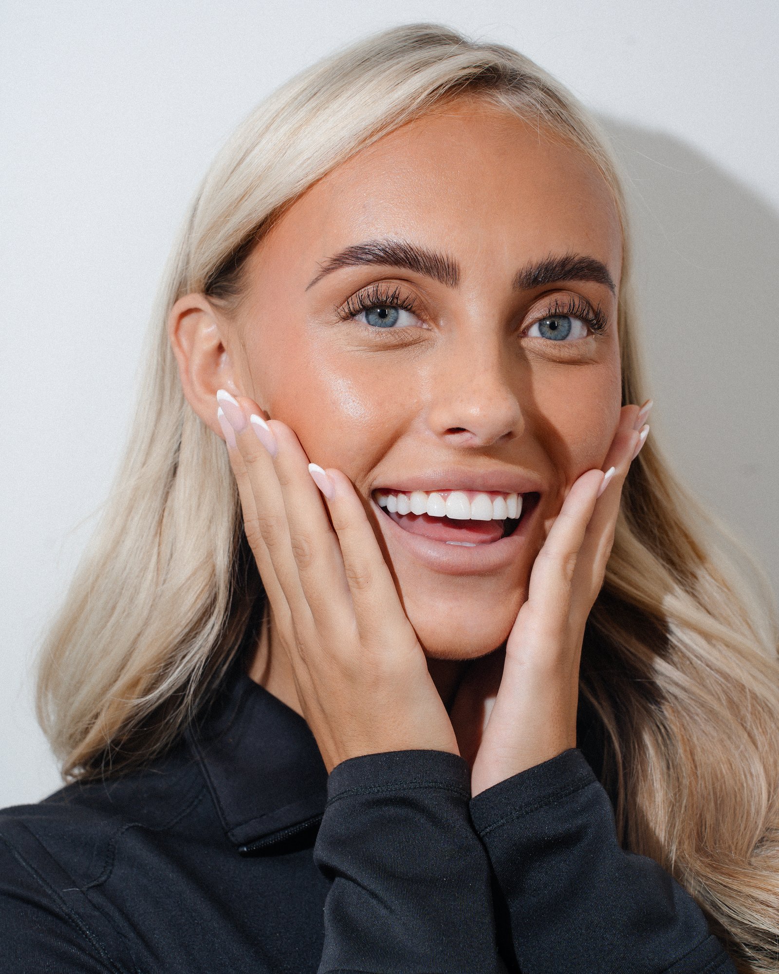 Patient smile after clear aligner treatment